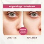 Bio Augencreme gegen Augenschwellungen und Augenringe – Bild 5