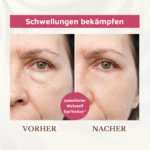Bio Augencreme gegen Augenschwellungen und Augenringe – Bild 4