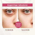 Augencreme und Reinigungsschaum für strahlende Augen - Kosmetiktasche Gratis – Bild 2