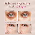Augencreme gegen Augenschwellungen und Augenringe inkl. Gua Sha Pils GRATIS – Bild 6
