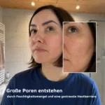 Frau mit großen Poren