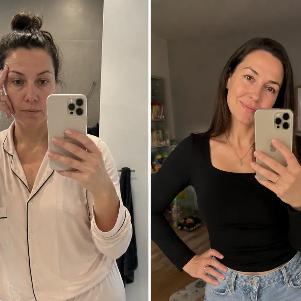 Augenringe Vorher Nachher Effekt